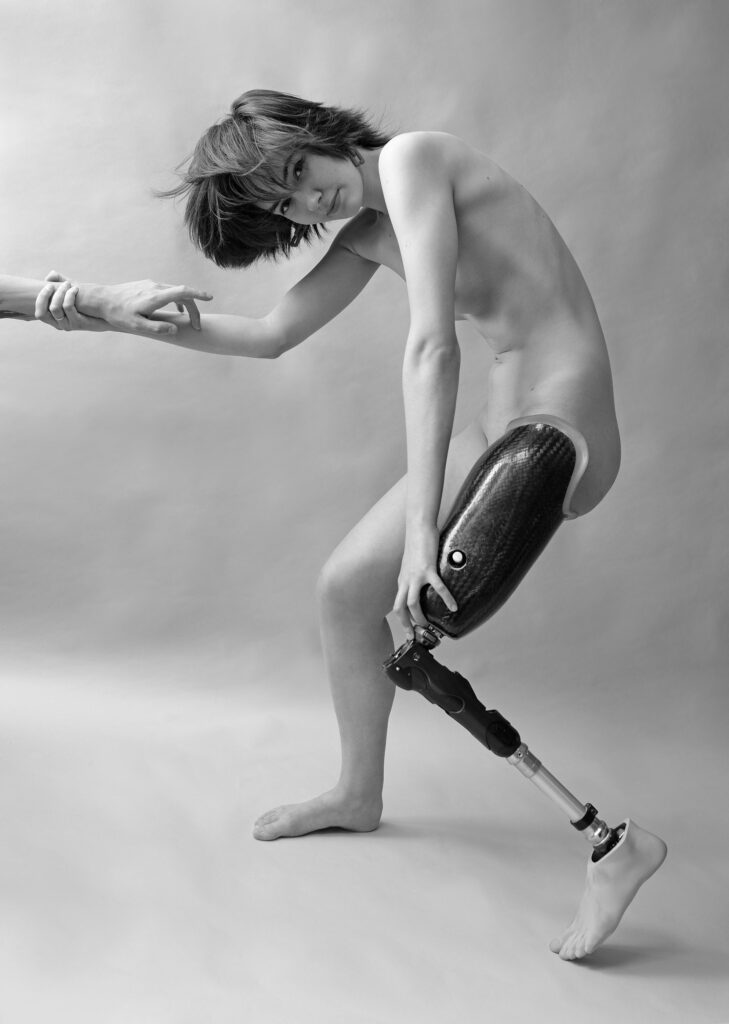 A female figure with a prosthetic leg poses nude in a black-and-white portrait. The composition is lush, dynamic, and carefully constructed, celebrating rather than diminishing the subject’s body.Having beaten cancer and lost a leg, the young woman refuses to hide her prosthesis. Her life philosophy- "Nothing is impossible"- is not a call for pity, but a testament to resilience, self-acceptance, and strength. Her scars are not erased; they are embraced as living proof of battles fought and won.In a world that often averts its gaze from disabled bodies, she insists on being seen, not as an object of pity, but as an agent of inspiration and dignity. This portrait embodies a quiet revolution: a demand that society see disabled people as equals.