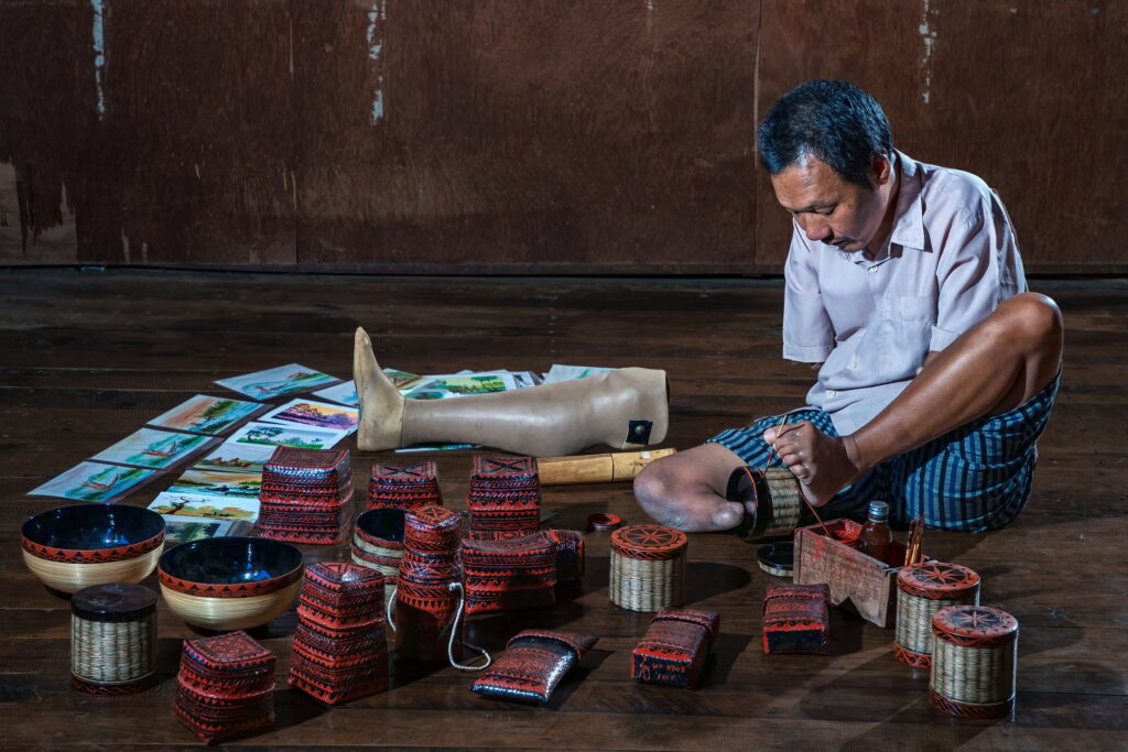 In a warmly lit studio, a man sits weaving a basket with precise movements of his feet. To the side, his leg prosthesis rests behind a small display of hand-painted postcards, quiet evidence of his artistic range.